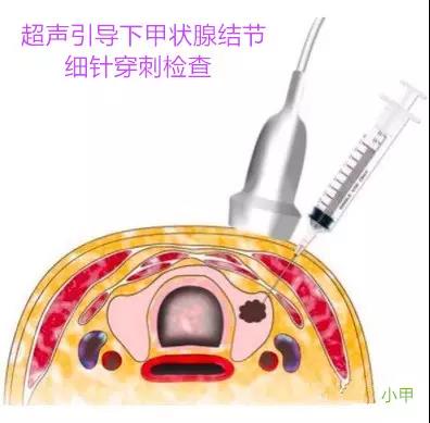 微信图片_20200330154109.jpg